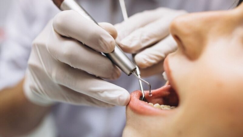 Em BH, escola para dentistas acompanha tendência de mercado