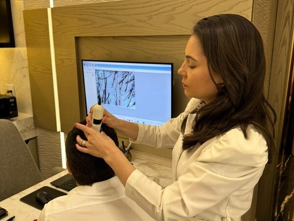 Genética é motivo da queda de cabelo em 80% dos pacientes