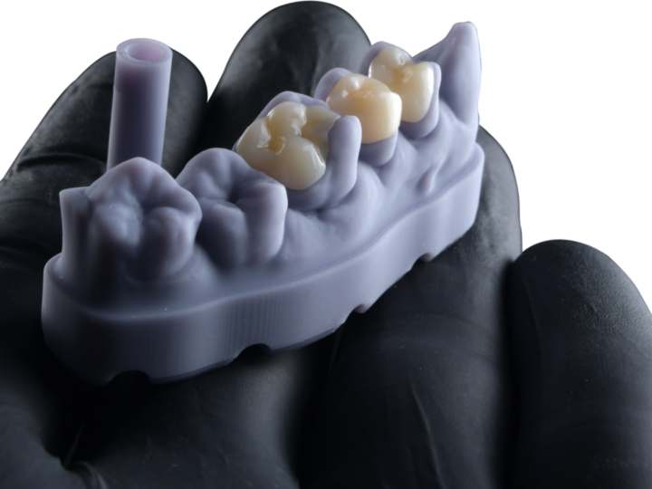 FGM Dental Group e dOne 3D apresentam a Voxelprint Ceramic