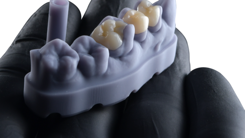 FGM Dental Group e dOne 3D apresentam a Voxelprint Ceramic