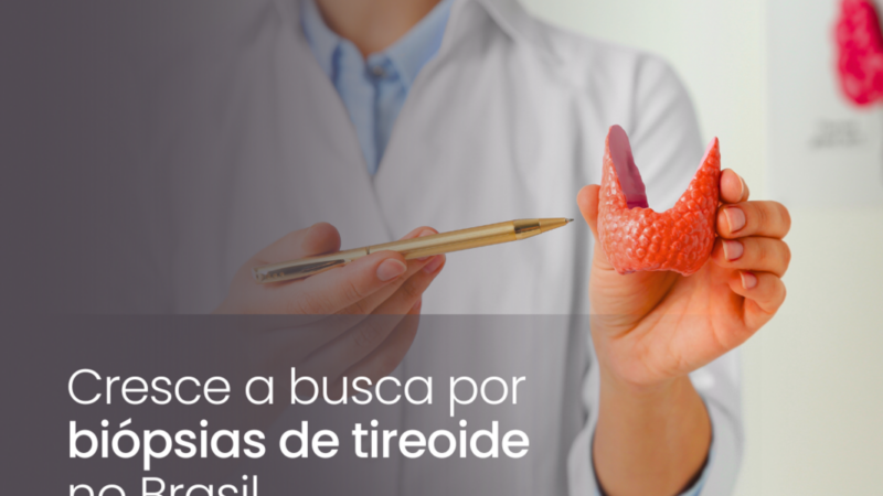 Cresce a busca por biópsias de tireoide no Brasil
