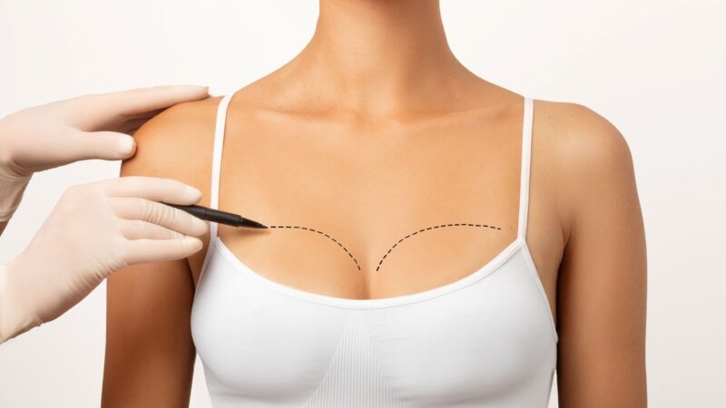 Cirurgia plástica: busca por resultados naturais é tendência