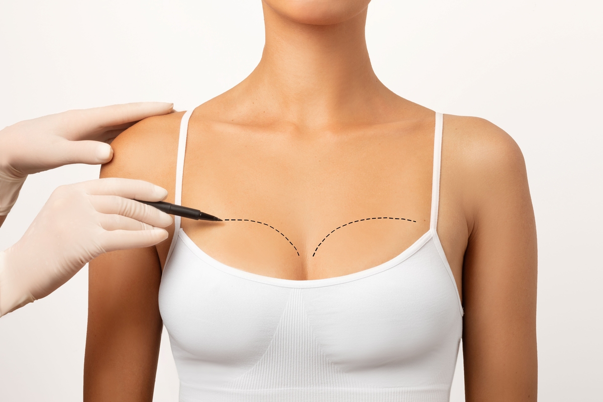 Cirurgia plástica: busca por resultados naturais é tendência