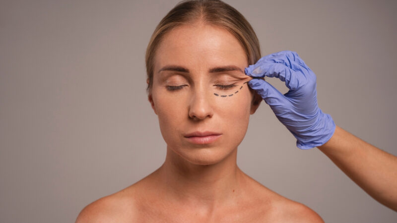 Cirurgia plástica ocular vai além da estética