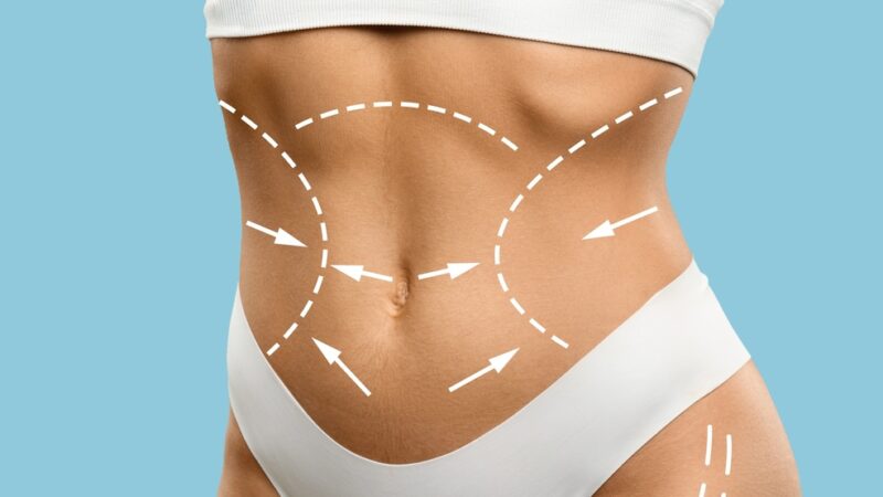 Tendências e tecnologia moldam o futuro da cirurgia plástica