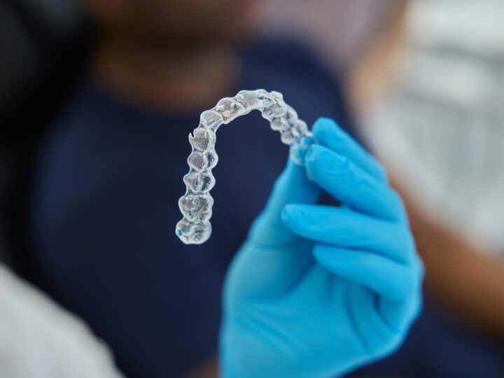 Além da estética: estudo revela vantagens dos alinhadores transparentes para a manutenção da saúde bucal durante o tratamento ortodôntico