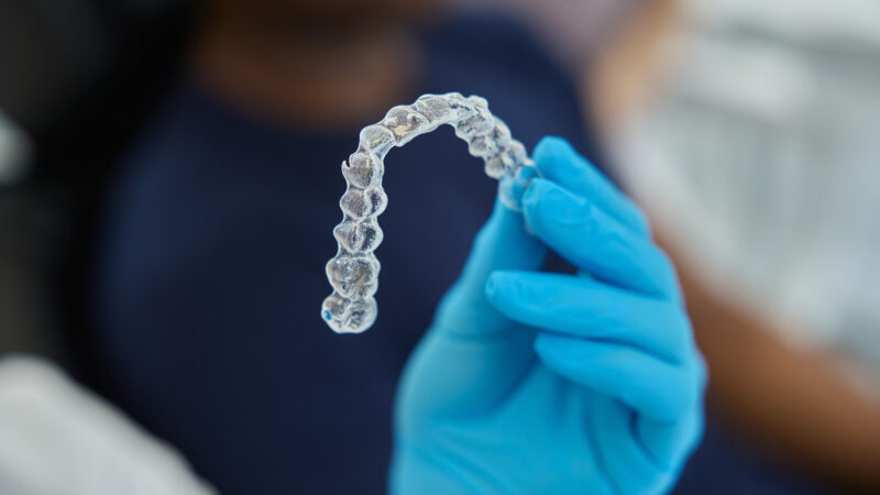 Além da estética: estudo revela vantagens dos alinhadores transparentes para a manutenção da saúde bucal durante o tratamento ortodôntico