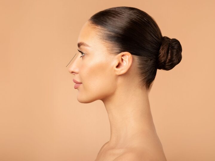 Rinoplastia ultrassônica gera avanços na estética facial
