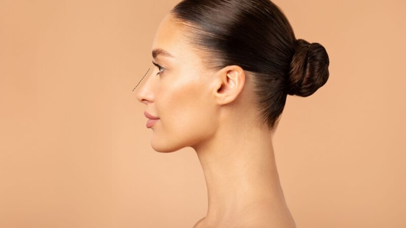 Rinoplastia ultrassônica gera avanços na estética facial