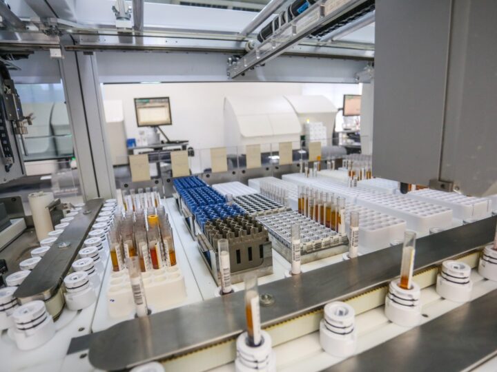 LANAC passa a oferecer exame avançado para investigação biológica da Doença de Alzheimer