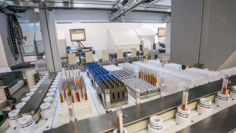 LANAC passa a oferecer exame avançado para investigação biológica da Doença de Alzheimer