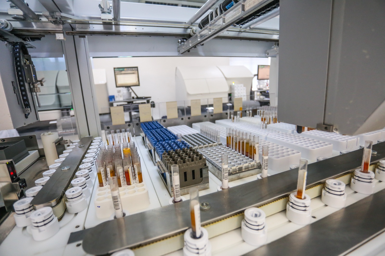 LANAC passa a oferecer exame avançado para investigação biológica da Doença de Alzheimer