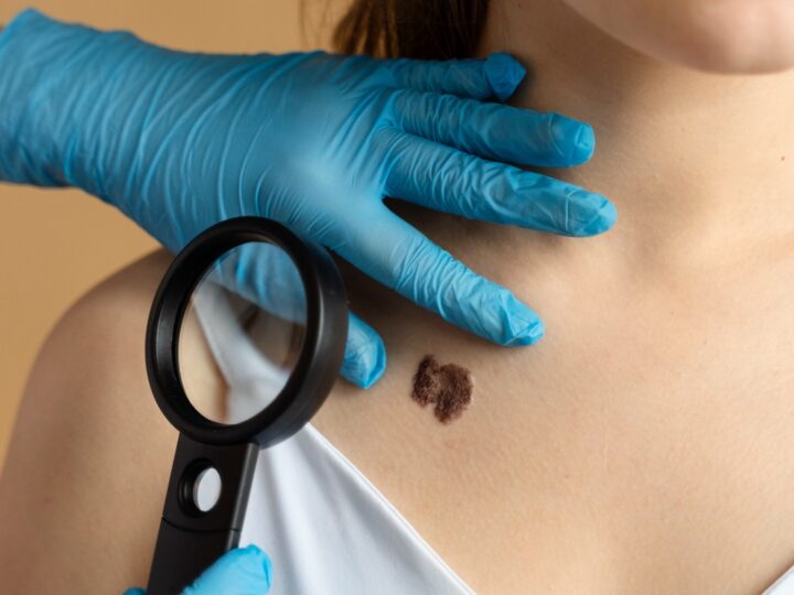 Dezembro Laranja reforça a importância do autocuidado e do check-up dermatológico para prevenir o câncer de pele