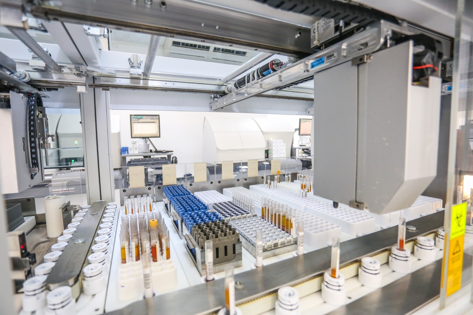 Exames de sangue podem indicar risco de câncer antes dos sintomas