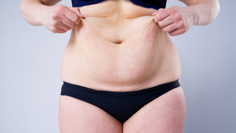 Cirurgias plásticas aumentam devido a canetas emagrecedoras