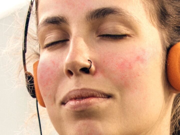 Pele sensível: especialista alerta para sinais e tratamentos