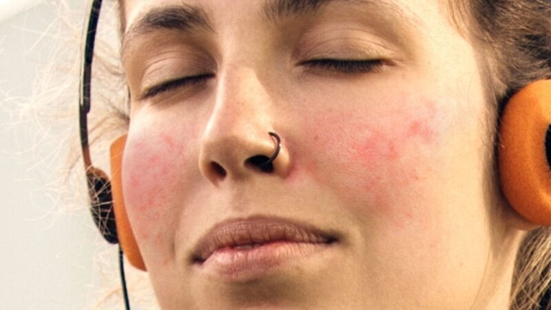 Pele sensível: especialista alerta para sinais e tratamentos