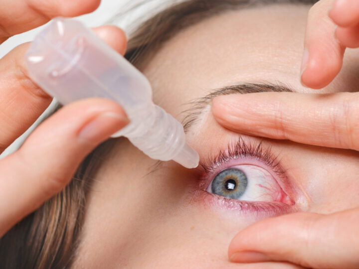 Tratamento da rosácea ocular avança com uso de tecnologia