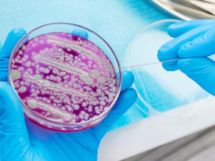 Resistência a antibióticos pode matar mais que câncer até 2050, alertam pesquisadores