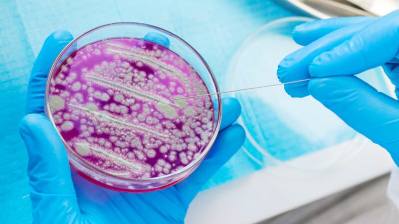 Resistência a antibióticos pode matar mais que câncer até 2050, alertam pesquisadores