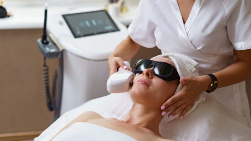 Lasers ganham espaço na dermatologia estética