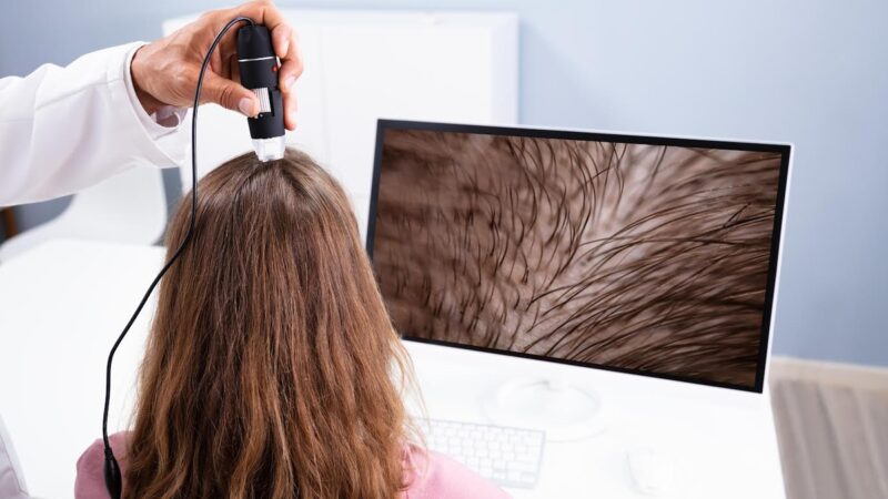 Tratamentos capilares ganham novas tecnologias