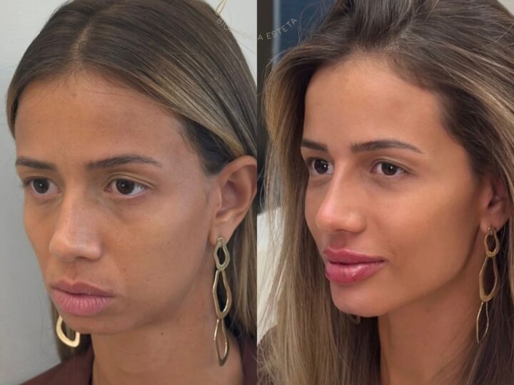 Beleza não é volume