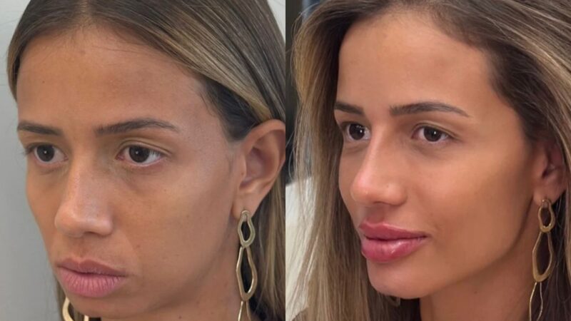Beleza não é volume