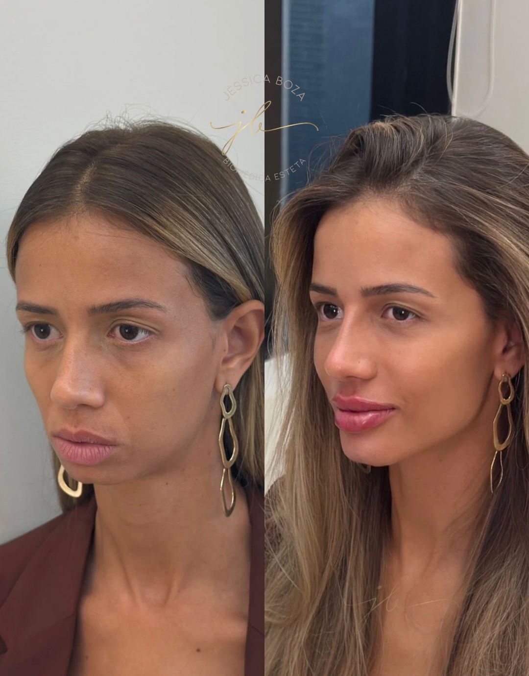 Beleza não é volume