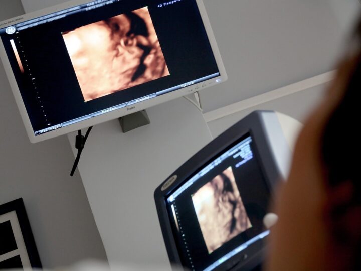 Pesquisa reforça técnica fetal para hérnia diafragmática