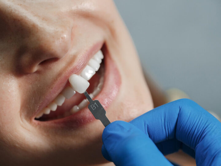 Falha em tratamento dentário nem sempre indica erro