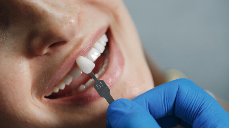 Falha em tratamento dentário nem sempre indica erro