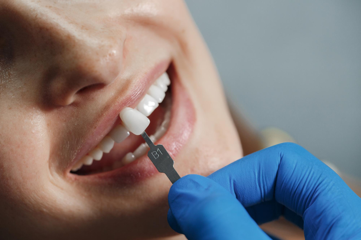 Falha em tratamento dentário nem sempre indica erro