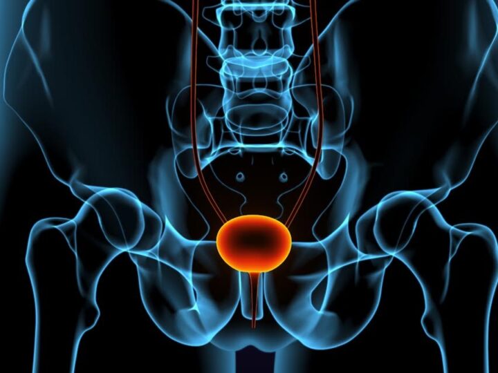 Urologista explica diferenças entre HPB e câncer de próstata