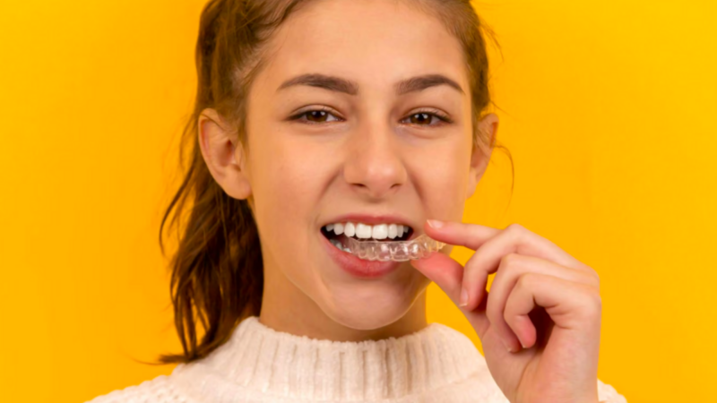 Alinhador invisível: como funciona o tratamento dentário