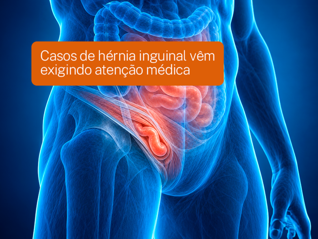 Casos de hérnia inguinal vêm exigindo atenção médica