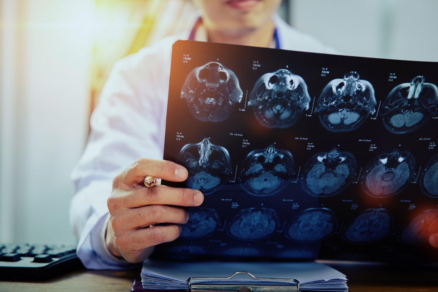 AVC em jovens: traumas leves no pescoço podem causar acidente vascular cerebral