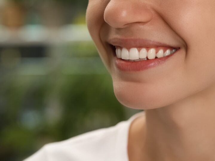 14 milhões de brasileiros vivem sem nenhum dente; perda dentária vai além da estética